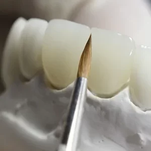Безметалловые конструкции зубных протезов