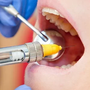 обезболивание в стоматологии