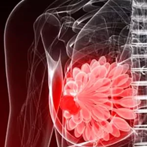Избранные вопросы мастопатии и рака молочной железы