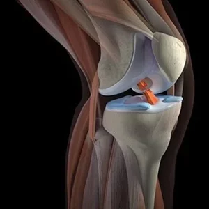 Основы Травматологии и ортопедии. Травма коленного сустава
